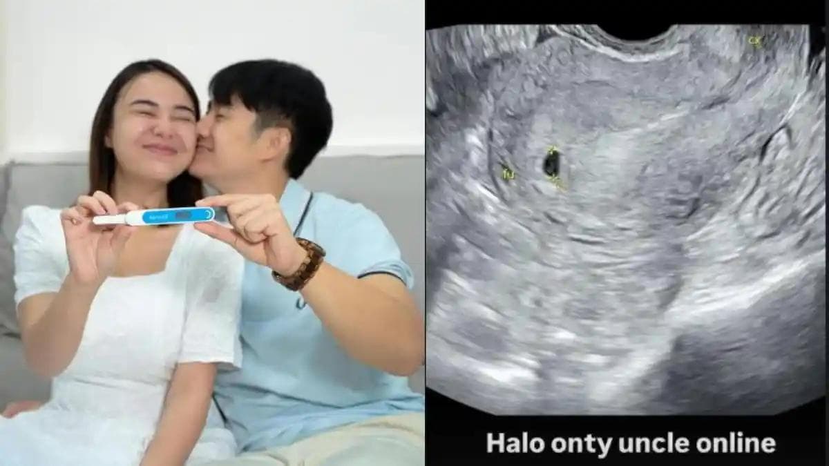 Garis Dua untuk Amanda Manopo: Babak Baru akan Jadi Ibu